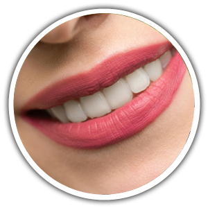 A Comprehensive Guide to Teeth Whitening in Katy